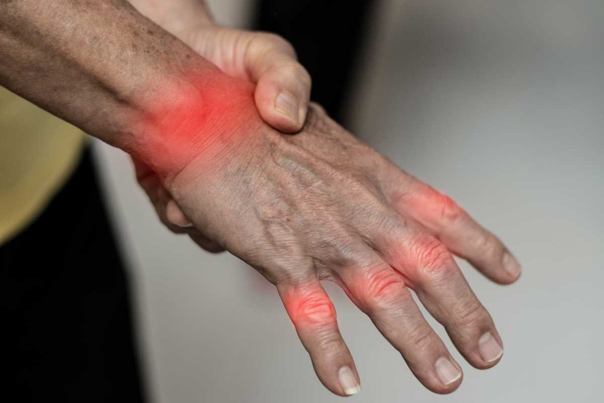 How to Minimize Flare-Ups When Managing Multiple Autoimmune Disorders